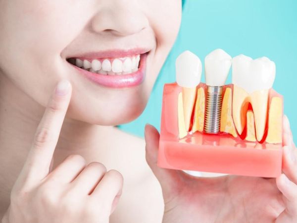 Are Dental Implants Considered Cosmetic?
